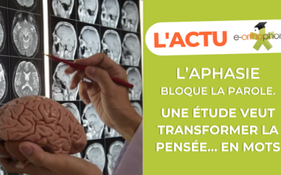 Une étude identifie les régions du cerveau pour la production de la parole chez les patients atteints d’aphasie